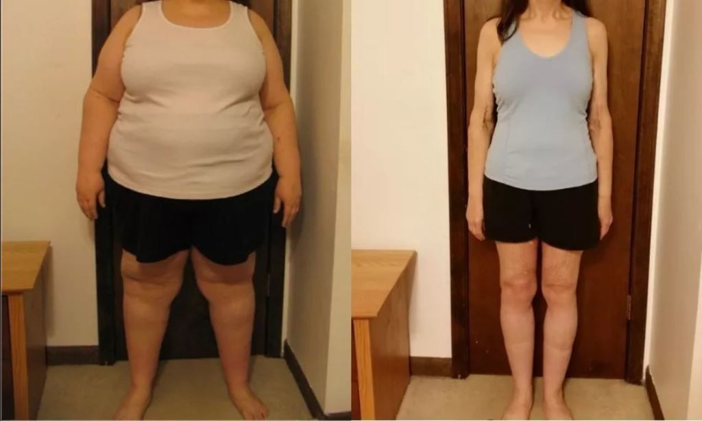 Weight Loss